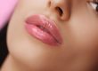 Lip filler can solve a variety of issues - Abilene TX