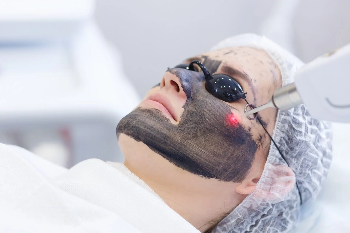 Laser Hair Removal by Abilene Beauty Bus in FM Buffalo Gap TX