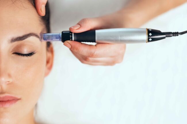 SkinPen Microneedling by Abilene Beauty Bus Abilene, TX