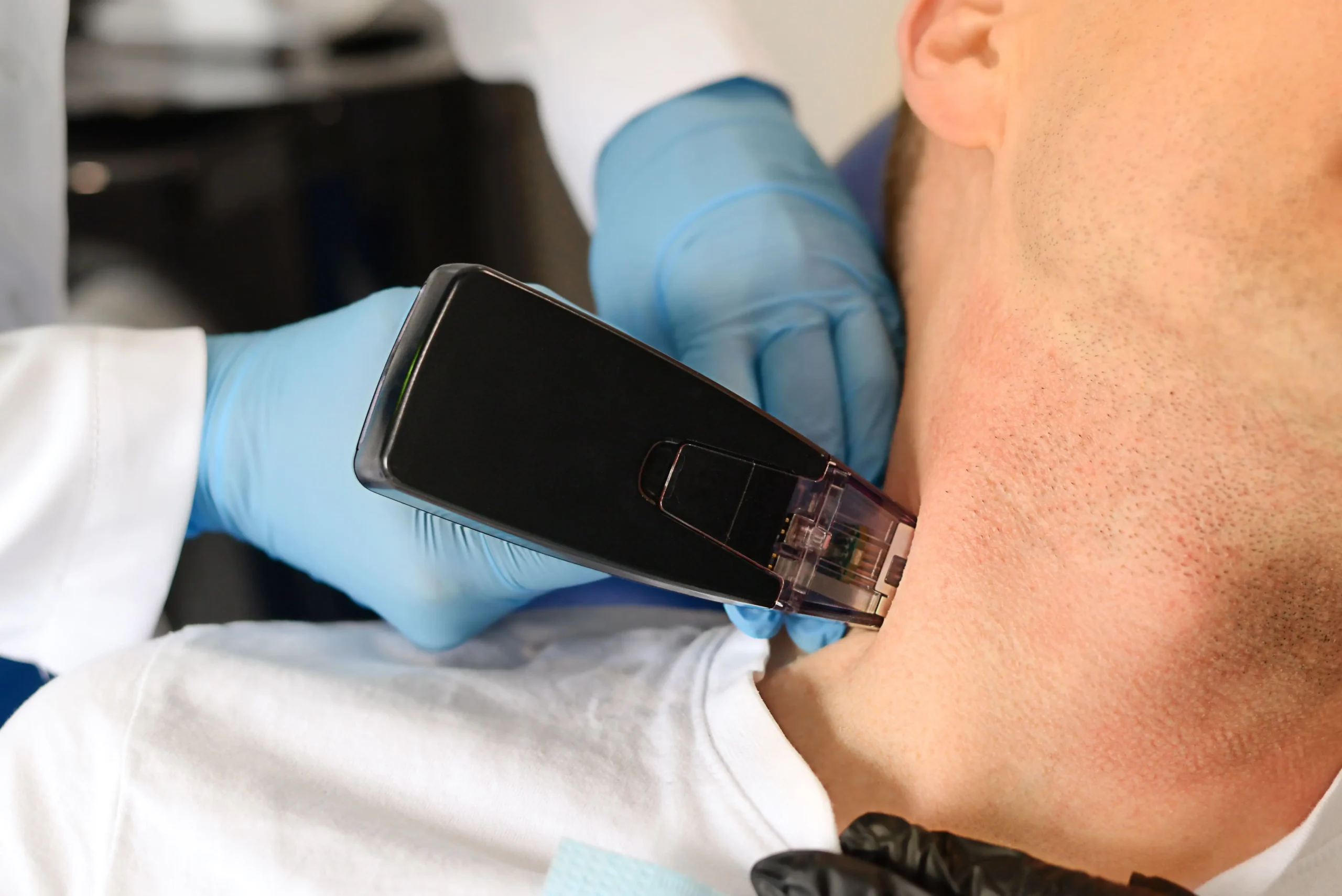 Abilene Beauty Bus | Morpheus8 Skin Treatment In Abilene, TX, and Buffalo Gap, TX
