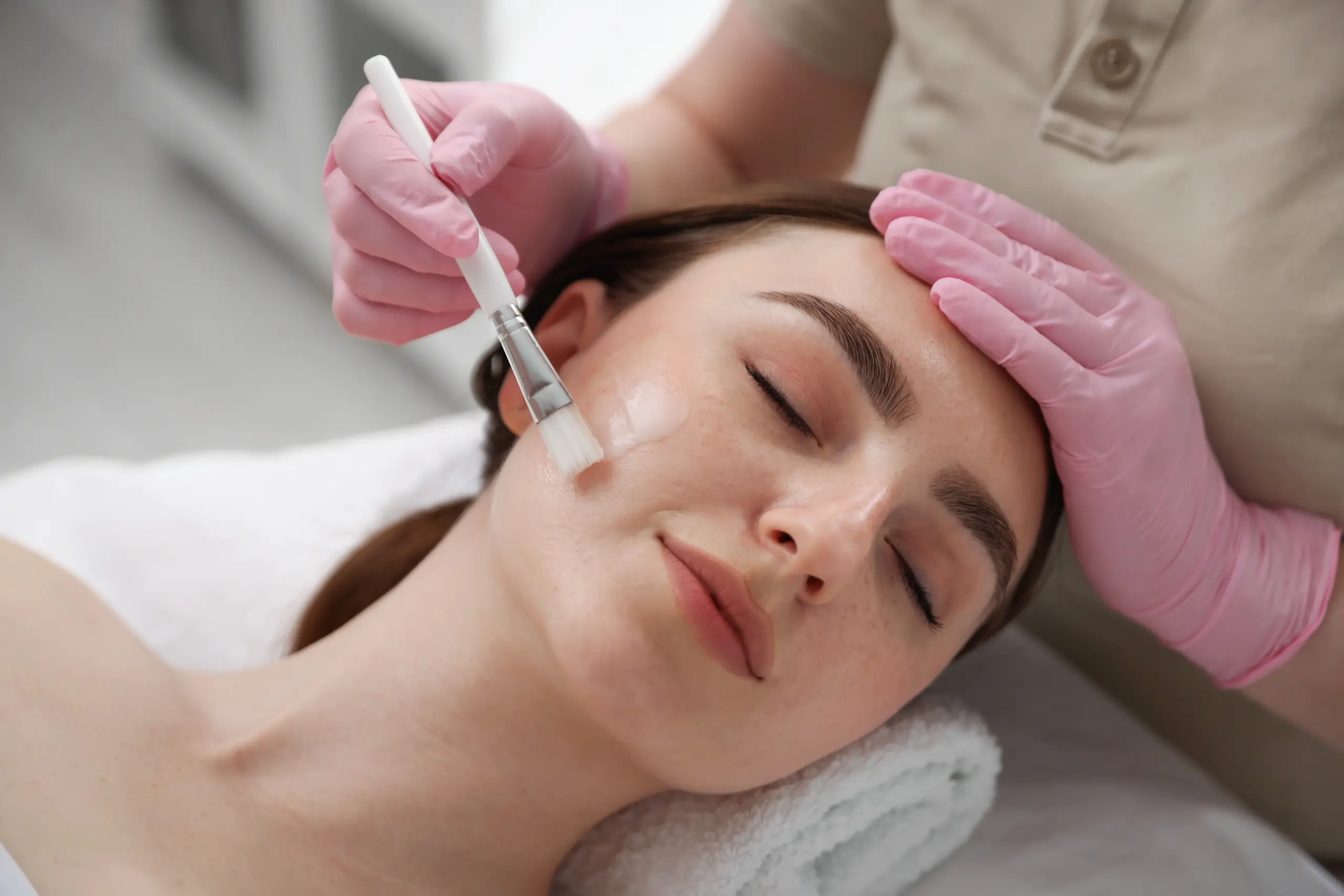 VI Peel® Treatment in Abilene, TX Abilene Beauty Bus